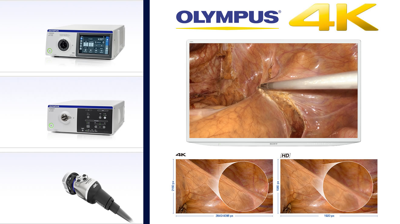 Olympus 4k Laporoscopy Image