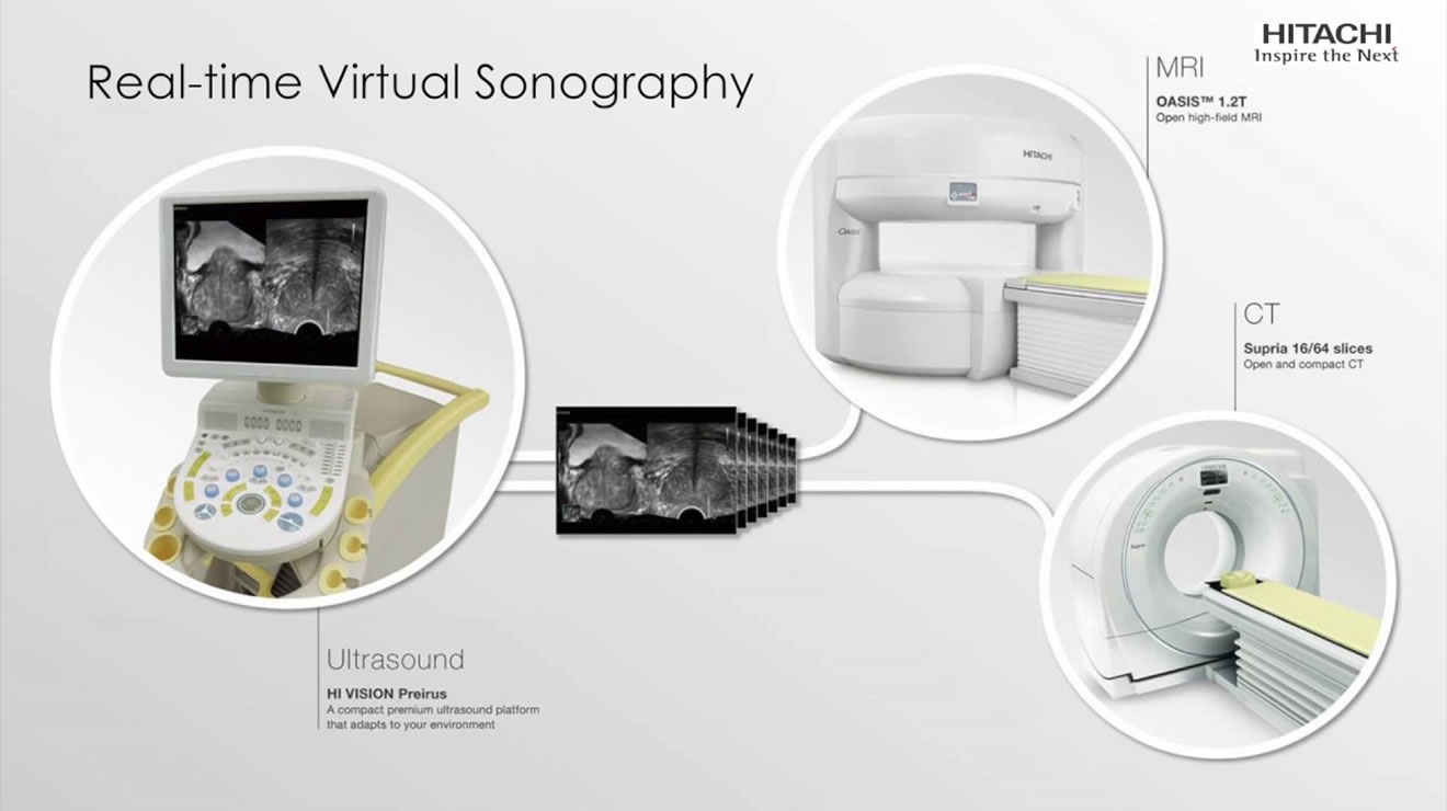 Real-time Virtual Sonography (RVS)